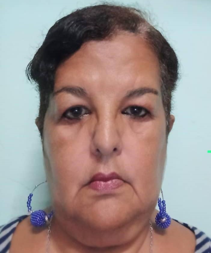 Zoraida Acunna Perez